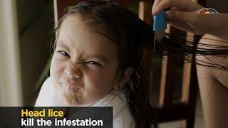 Head Lice, facts and myths.