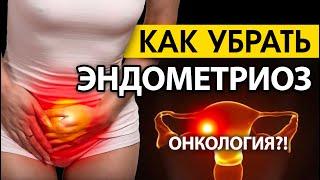 Как убрать Эндометриоз - Гормональный сбой - Онкология - Катерина Святкина - канал о психологии