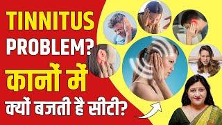 Tinnitus Treatment || How To Cure Tinnitus By Acupressure Points || Dr. Richa Varshney