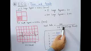 ECG Basics - Times and Speeds | Large and Small Squares/Boxes | Calculation of Heart Rate