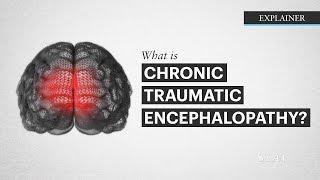 What is CTE?