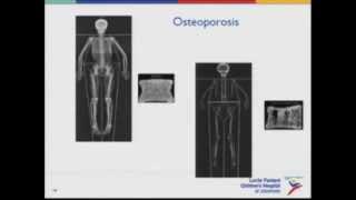 Eating Disorders  Acute and Chronic Health Impacts Part 1 of 2