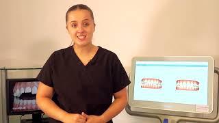 Croydon Orthodontic Practice- Mild Cases