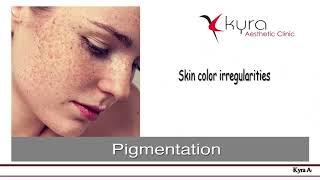 Best Treatments for Hyperpigmentation | Pigmentation Treatment in Ludhiana Punjab by Dr Vikas Gawri