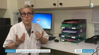 Les symptômes d'un cancer du poumon