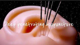 ASMR  Putting acupuncture in the ear penetrating the brain [Penetration 100%, long Ver.](no talking)