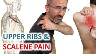 Scalene and Upper Ribs Release for Thoracic Outlet Syndrome (TOS)