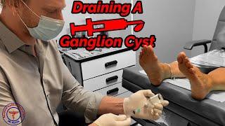 Dr. Kilfoil Drains A Ganglion Cyst!