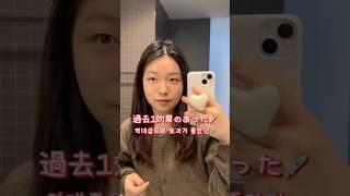 My skin has gotten better than ever after the last skin treatment #KoreanSkinTreatment #Korea #Ja...