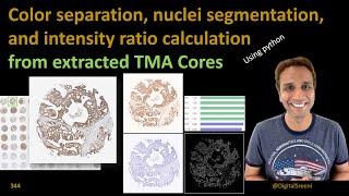 344 Color separation and nuclei segmentation in cores extracted from TMA