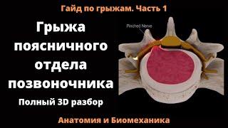 Грыжа поясничного отдела позвоночника. Полный 3D разбор.