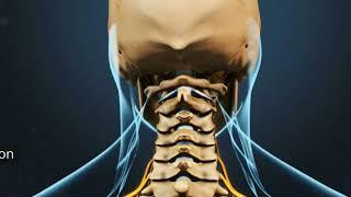 Cervical Radiculopathy Treatment | Exercises for Neck Pain | @DrAimanUbaid