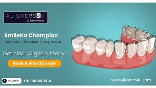 TEETH STRAIGHTENING WITH ALIGNERS4U | LIMITED TIME OFFER | MOST AFFORDABLE ALIGNERS IN HYDERABAD