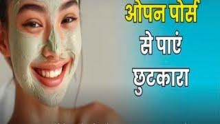 ओपन पोर्स को हटाने का रामबाण इलाज | How to get rid of open pores