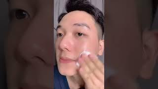 Điều trị mụn thâm tại nhà đơn giản