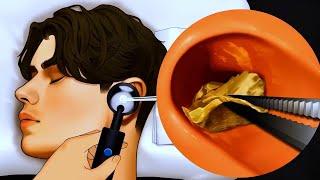 ASMR | Ear Cleaning and Earwax Re