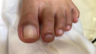 Esmaltação Branquinha