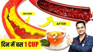 Clear Blocked Arteries | 14 दिनों में बंद नसें साफ करे | Best Home Remedy For Cholesterol Plaque