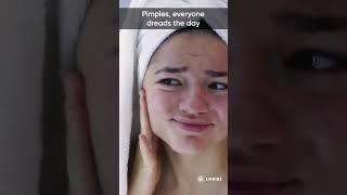 Why do we get pimples? | Interesting Facts | Ankana Kumari | Embibe | Shorts