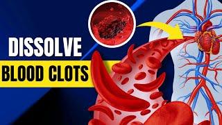 10 Foods That Dissolve Blood Clots Naturally (Doctors WON'T Tell You)