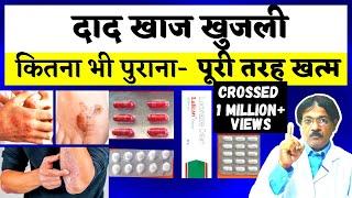 Dad Khaj Khujli Ki Dawa | दाद खाज खुजली को जड़ से ख़तम कैसे करे? | 3 Best Medicine For Dad Khaj Khujli