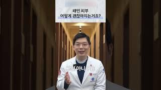 연예인 패인피부 어떻게 좋아지는거죠? #여드름흉터#패인피부#피부과