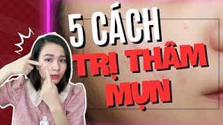 5 cách trị thâm mụn nhanh chóng ngay tại nhà! | Nguyễn Mai Hương