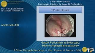 Gastric Perforation at Endoscopy: How to Manage Nonoperatively