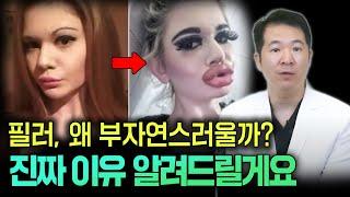 아무도 말 안해주는 필러시술이 부자연스러운 이유, 필러 부작용의 모든 것