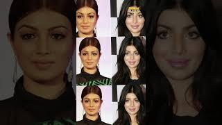 Bollywood Actress जिन्हें plastic surgery ने किया बर्बाद ! Bollywood Plastic Surgery