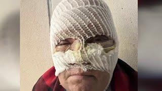 Woman attacked, burned with chemicals while inside her apartment