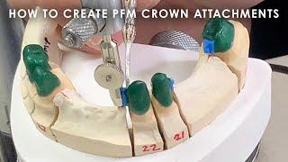 How to create PFM Crown Attachments