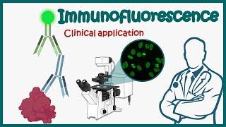 Immunofluorescence | Direct and Indirect Immunofluorescence | clinical application of IF.