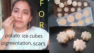 #potato ice cubes#DIY#for #dark spots#pigmentation