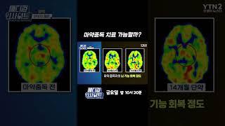 마약중독 치료 가능할까?
