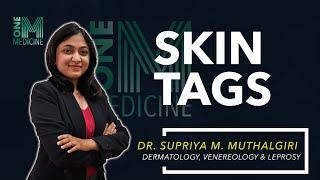 Skin Tags | Dermatology | OneMedicine