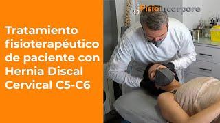 Tratamiento fisioterapéutico para Hernia Discal | Discopatía Degenerativa C5-C6