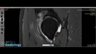 Hip Case from Saturday Evening MSK Radiology LIVE - in 4K (21:9 ratio)