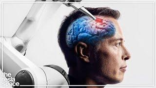 The 2022 Neuralink Update Is Here!
