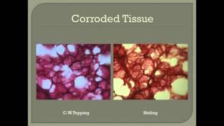 Histopathology in the Nineteenth Century: Virchow to Frozen Sections