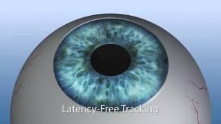 Safety during laser treatment with SCHWIND AMARIS 1050RS with 7D Eyetracking