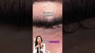 Dr V Triple Action eye cream #milia #eyecreams