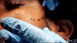 Melting Moles?! Satisfying - Dr. Bumpinator