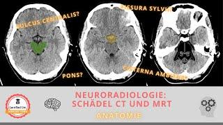 Anatomie im CT und MRT Schädel