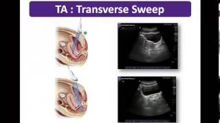 Basic Applications : Female Pelvis - Scanning Techniques