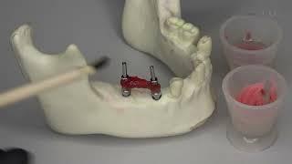 ConicalFIT Multi Unit Screw Retained Abutment