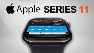 Apple Watch Series 11 Overview: What to Expect