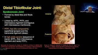 Dr. Jeimylo de Castro talks about MSK Ultrasound of the Ankle/Foot-Part 1