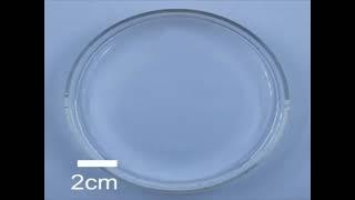 A tear-soluble contact lens with silicon nanoneedles to treat eye diseases