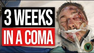 I was in a coma for 3 weeks